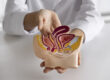 Crohn's Disease
