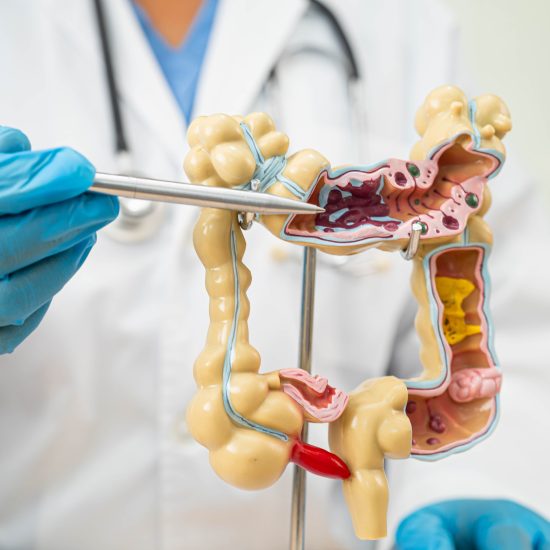 Hernia Treatment in Dombivli