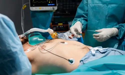 Colon and intestinal surgerie Colon and intestinal surgerie