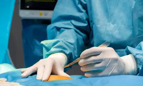 Gallstone and biliary tract surgeries Gallstone and biliary tract surgeries