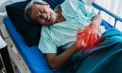 Gastric ulcer perforation & intestinal obstruction surgeries Gastric ulcer perforation & intestinal obstruction surgeries