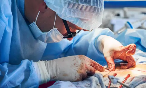 Piles surgery Piles surgery