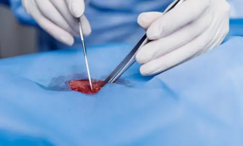 Soft tissue surgeries Soft tissue surgeries