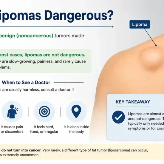 Are Lipomas Dangerous?