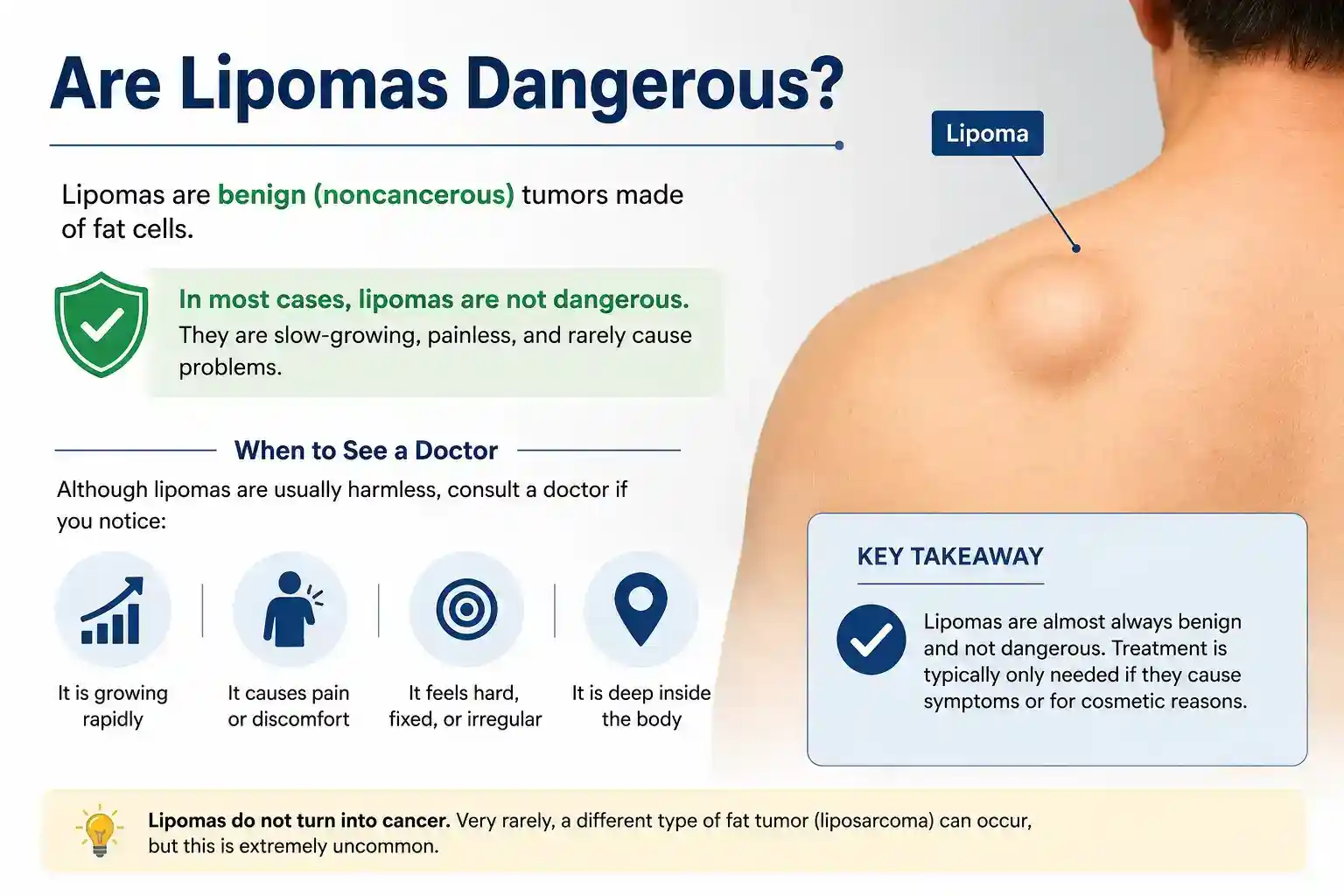 Are Lipomas Dangerous?