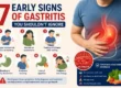 7 Early Signs of Gastritis You Shouldn't Ignore